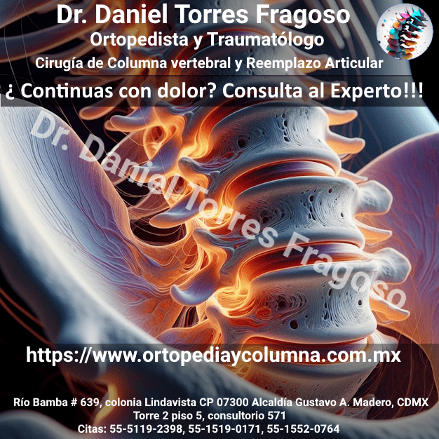 Eficacia de la cerámica de fosfato de calcio bifásica con una topografía de superficie en forma de aguja frente al autoinjerto en la fusión espinal posterolateral instrumentada